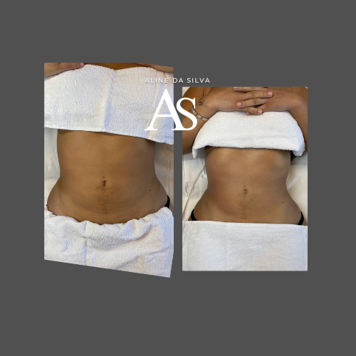 POST SURGERY BASIS cursus voor beginners.