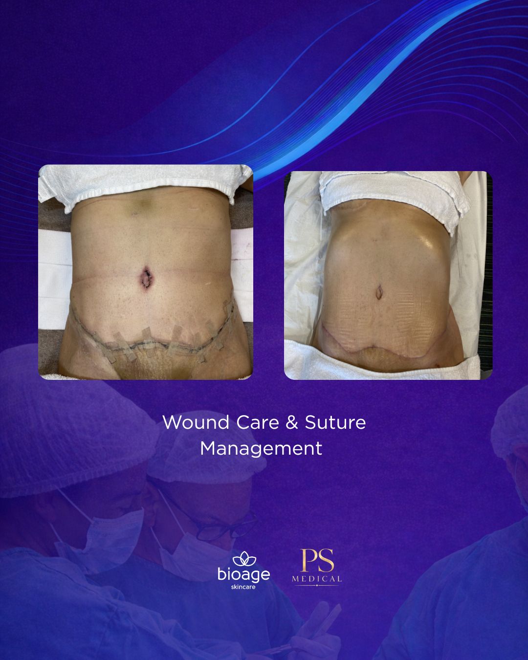 ADVANCED POST SURGICAL MASTERCLASS