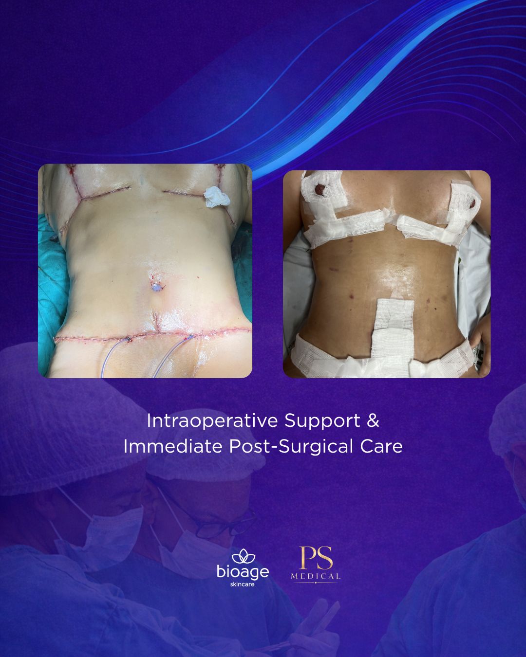ADVANCED POST SURGICAL MASTERCLASS