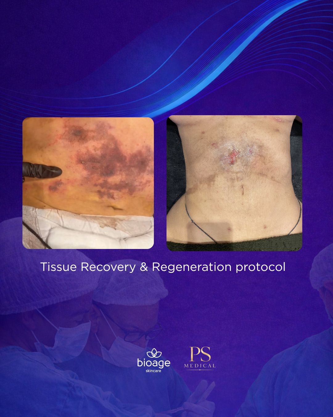 ADVANCED POST SURGICAL MASTERCLASS