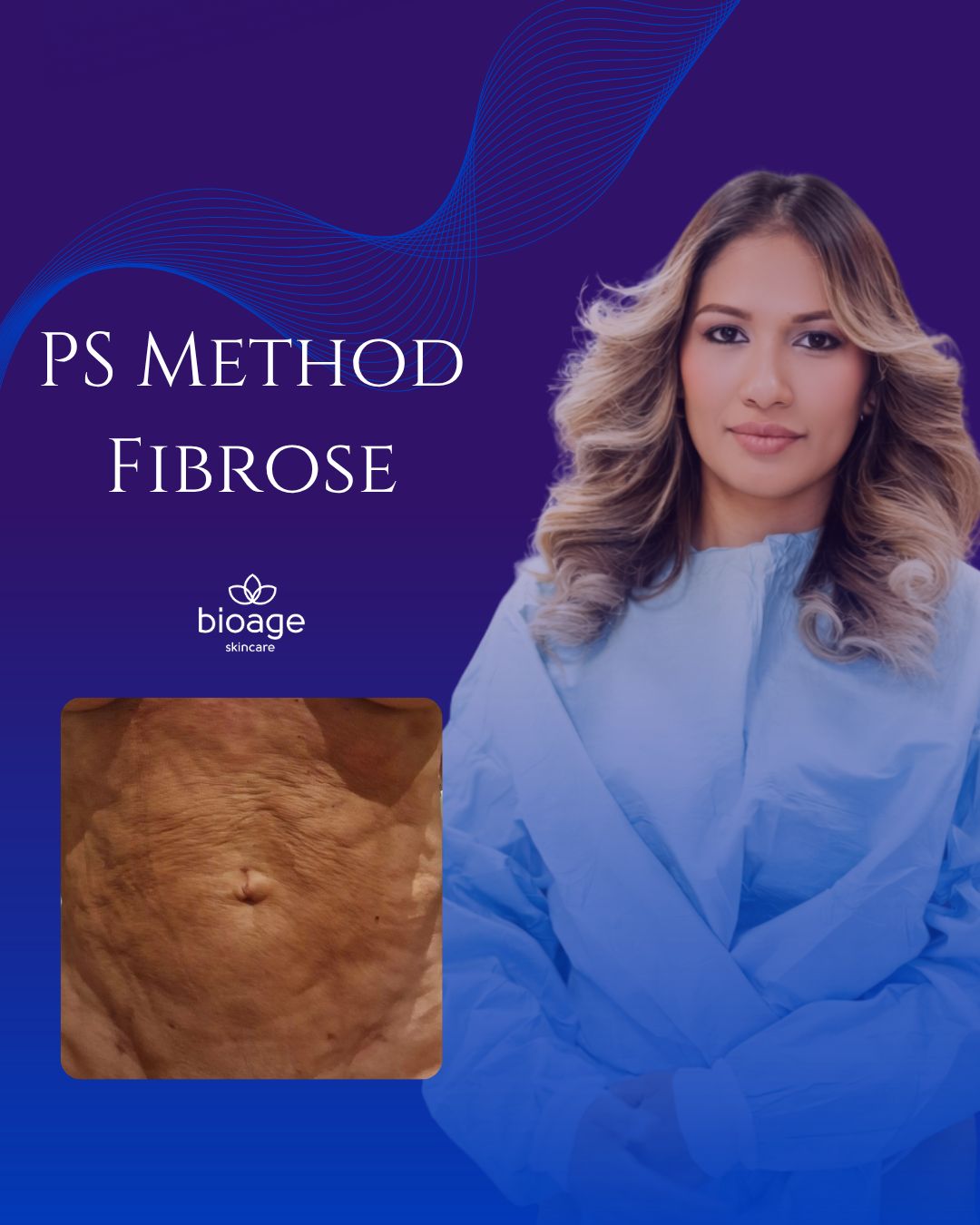 Masterclass Method FIBROCURE advanced treatment of fibrosis