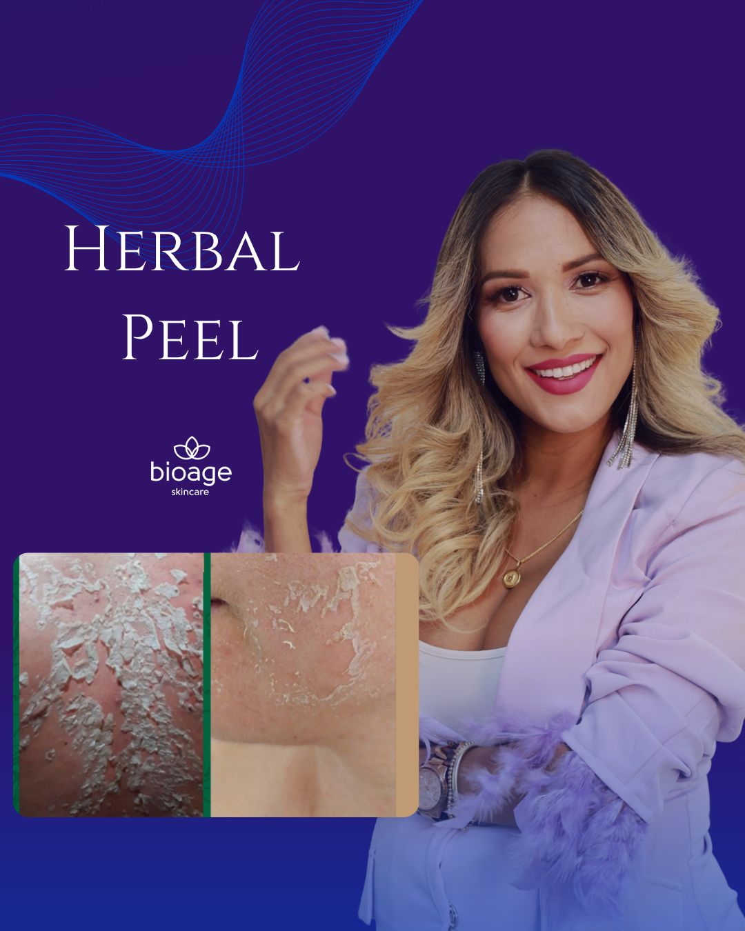 HERBAL PEEL BIOAGE MASTERCLASS